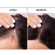 Cargar imagen en el visor de la galería, Antes y después tratamiento anticaida para la caída del cabello, pelo fuerte y sano