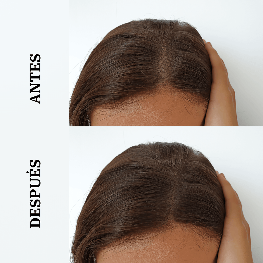 tratamiento capilar contra la caida